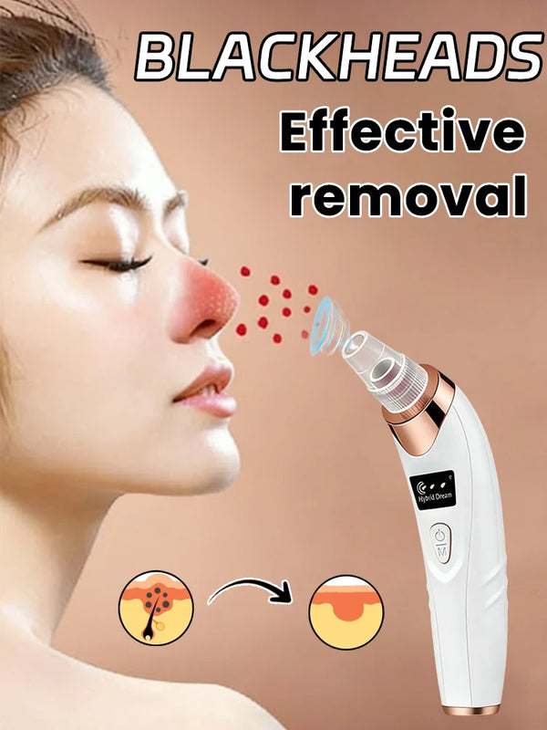 Blackhead Remover Vacuum